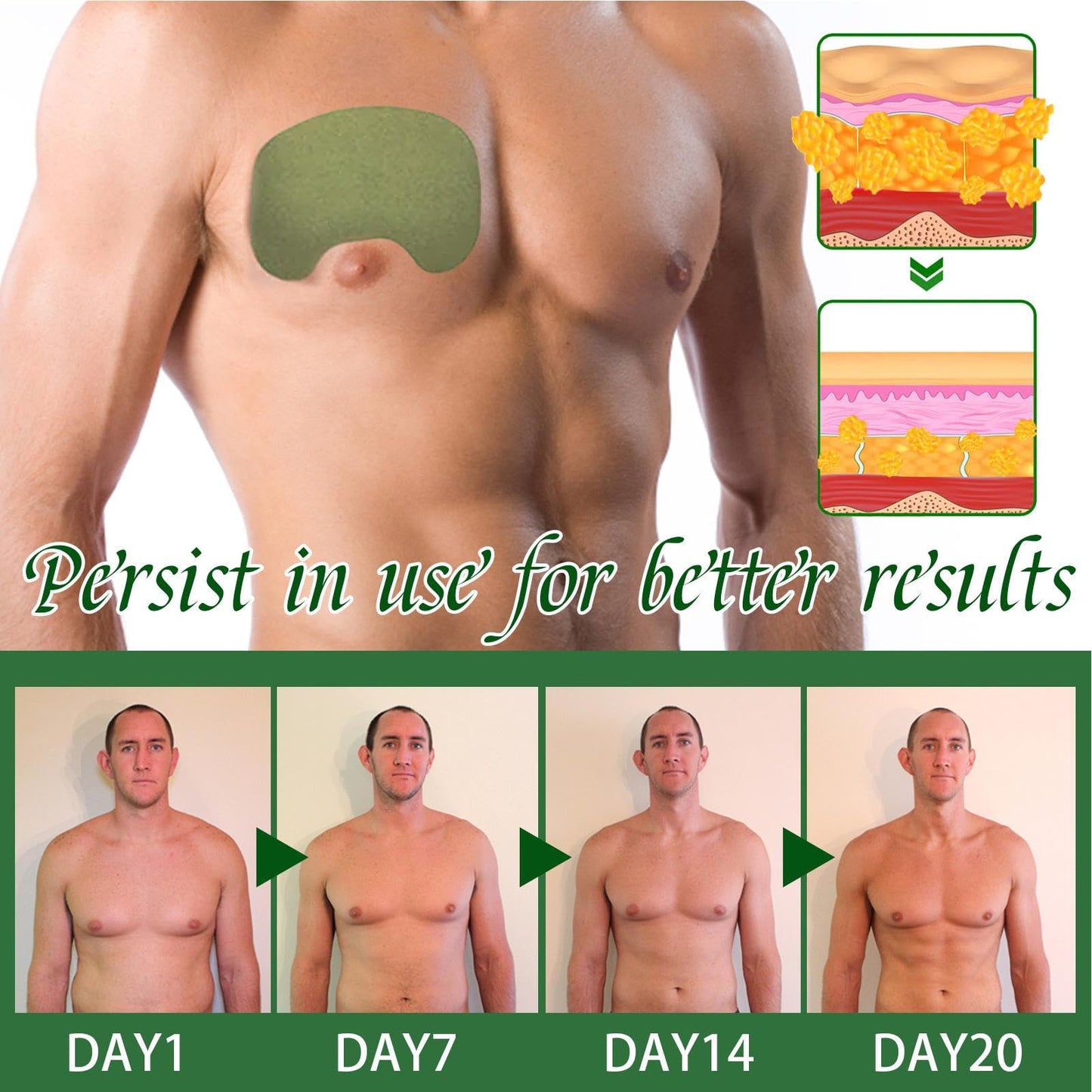 Patch de compresse pour gynécomastie