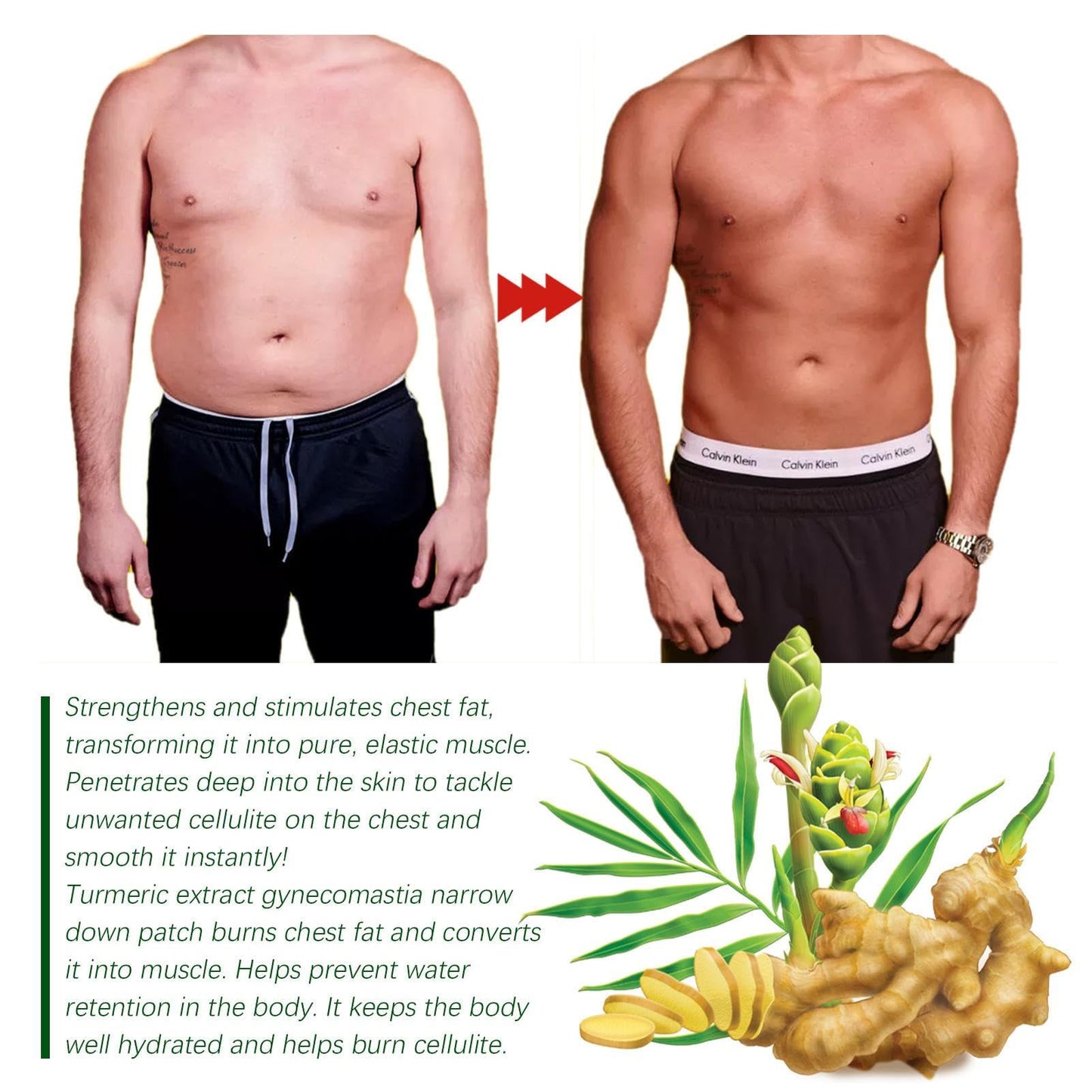 Patch de compresse pour gynécomastie