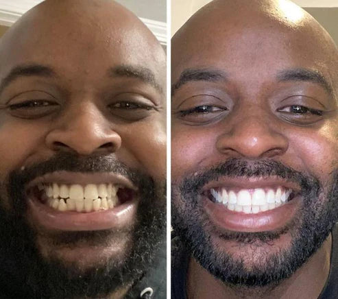 Dentifrice blanchissant