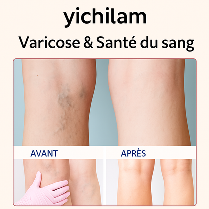 Capsules d'Hirudine, compléments alimentaires pour lutter contre les varices