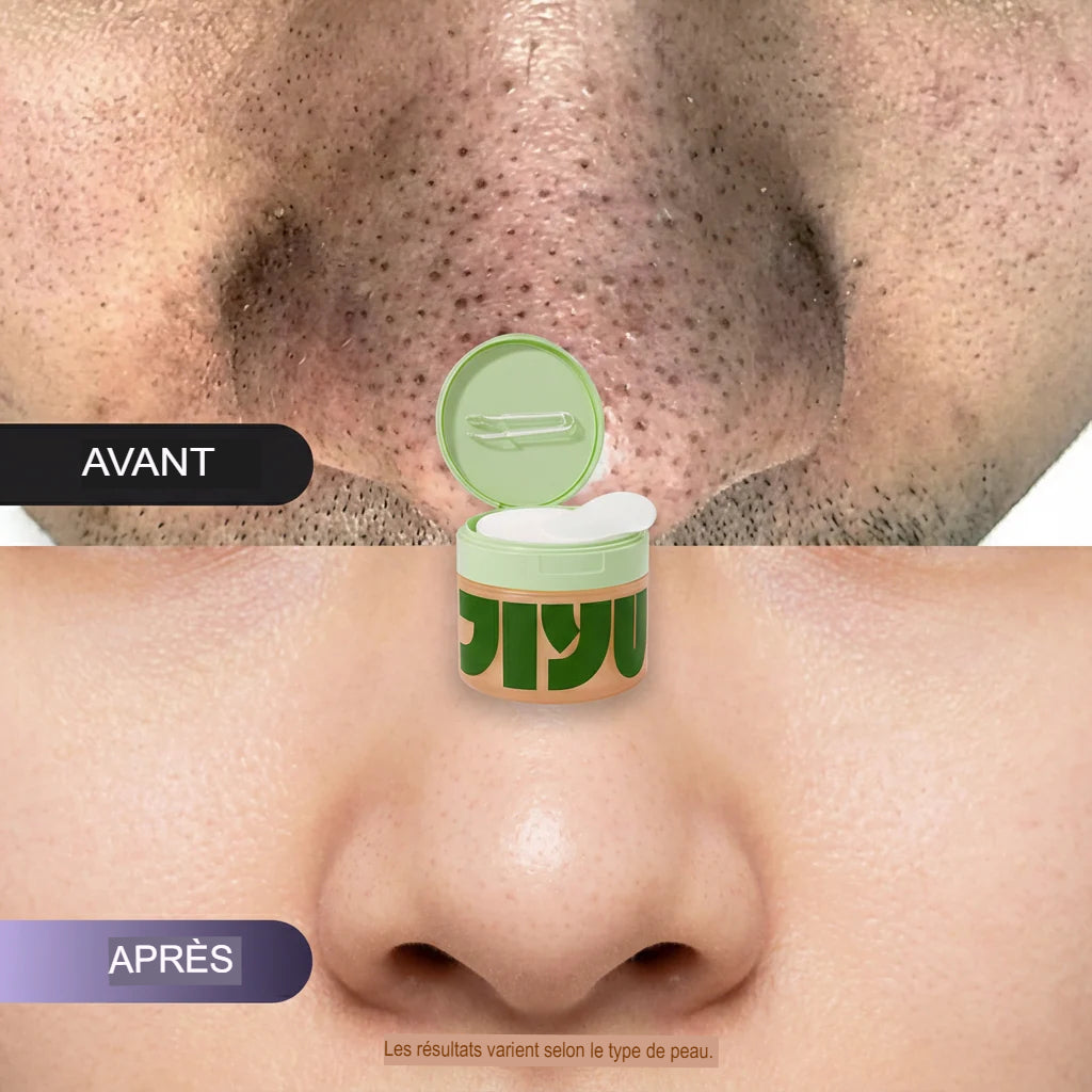 JiYu Toning Polish Pads-Soin pour les taches brunes