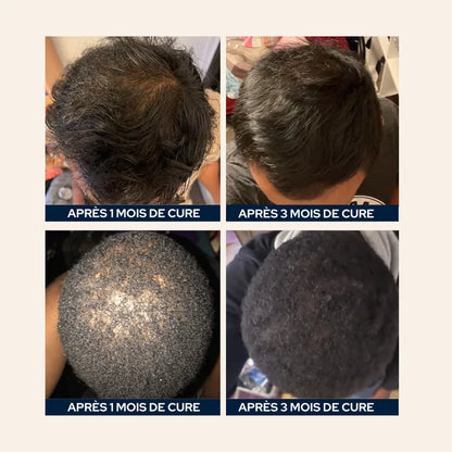 Gélules d'huile de pépins de courge