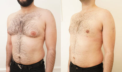 capsules de testostérone turkestérone tongkat ali