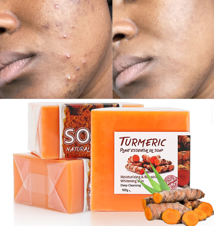 Savon au Curcuma- Peau Radieuse