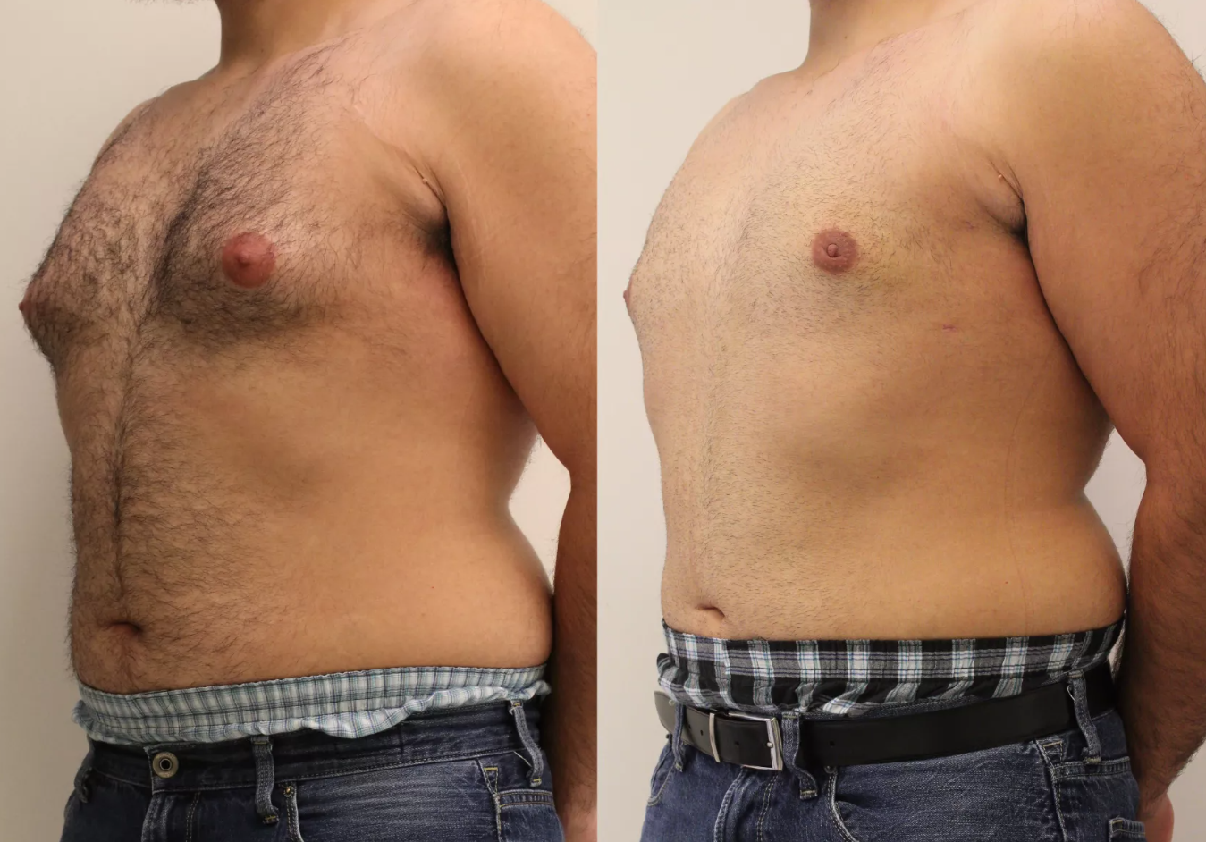 capsules de testostérone turkestérone tongkat ali