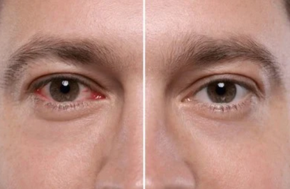 Complément Naturel pour le Confort des Yeux