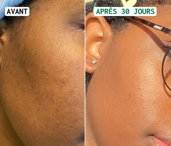 JiYu Toning Polish Pads-Soin pour les taches brunes