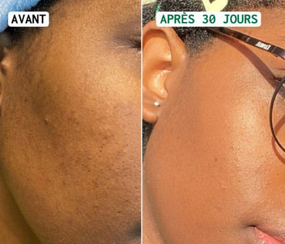 JiYu Toning Polish Pads-Soin pour les taches brunes