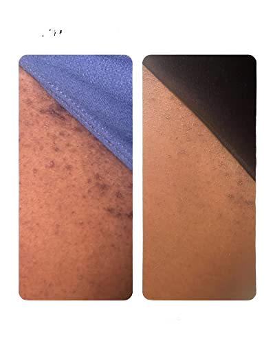 ROLL-ON ANTI POILS INCARNÉS barbes, visage, maillot et corps