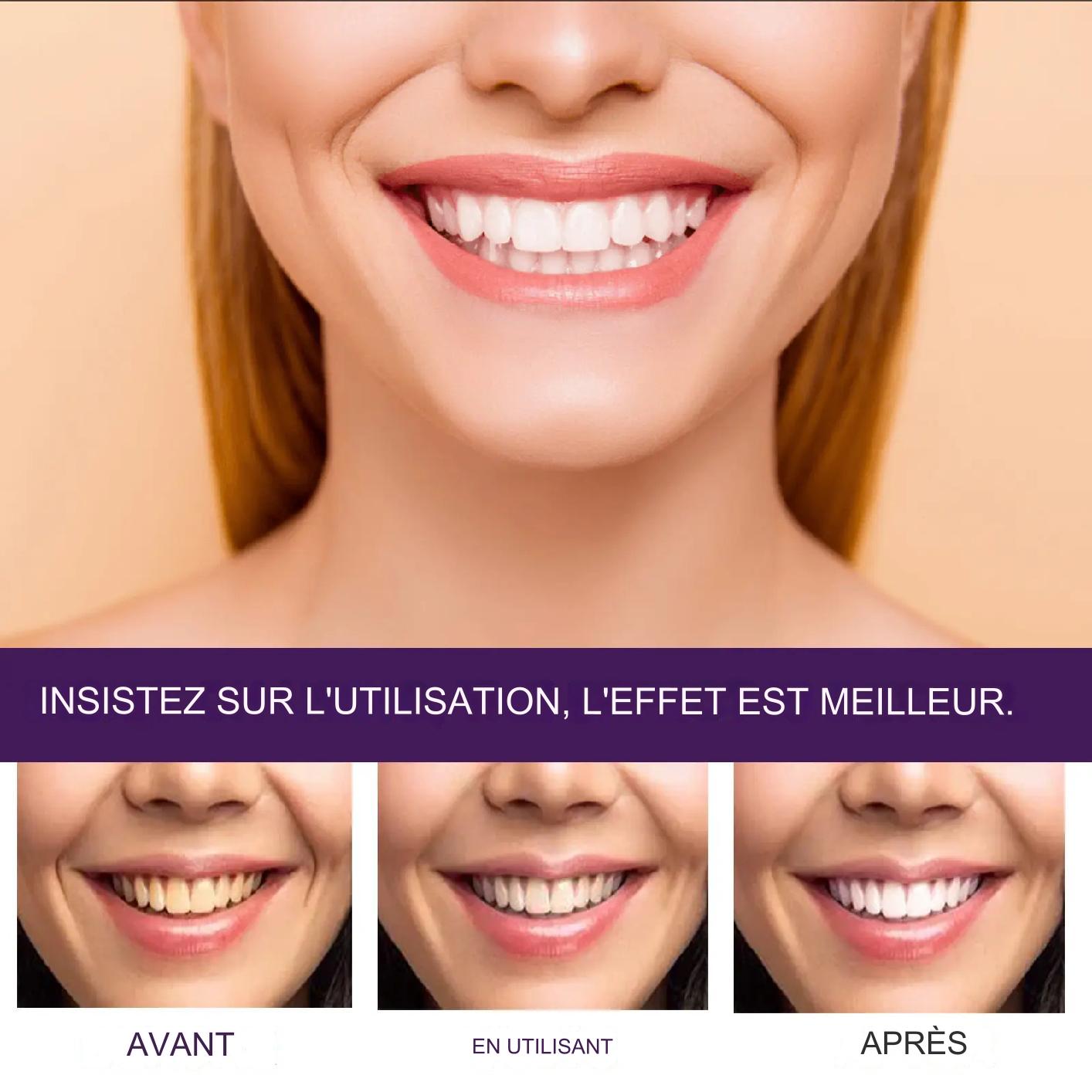 Dentifrice Violet pour Blanchiment des Dents
