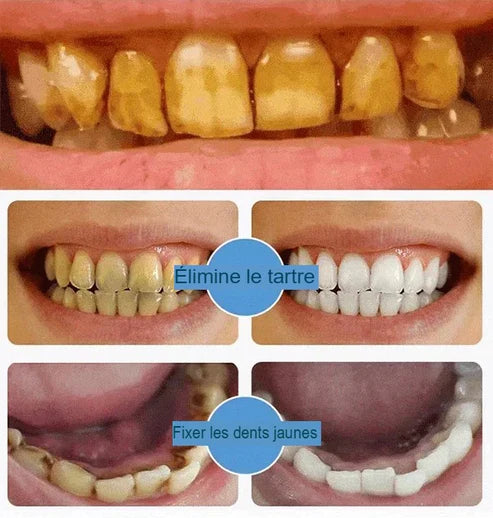 Dentifrice blanchissant