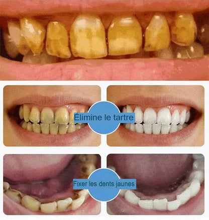 Dentifrice blanchissant