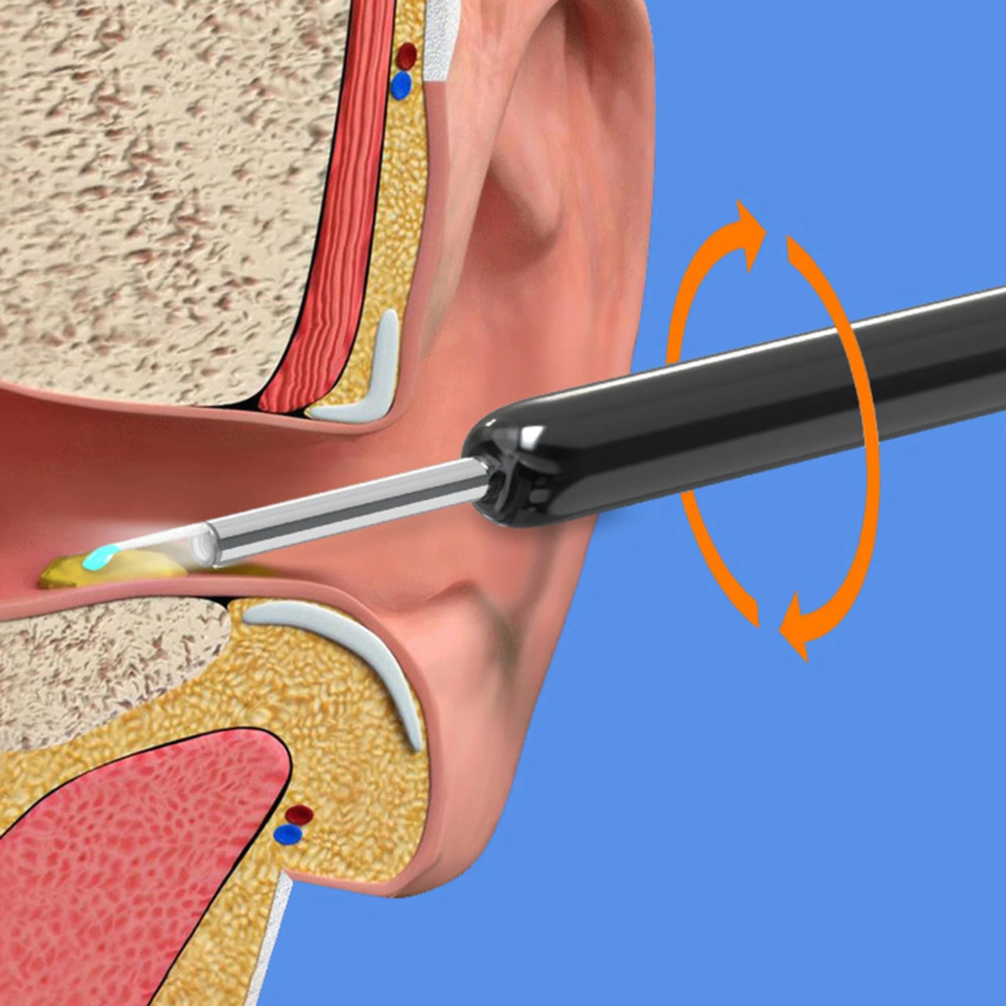 Outil de suppression d'avertissement d'oreille de haute précision