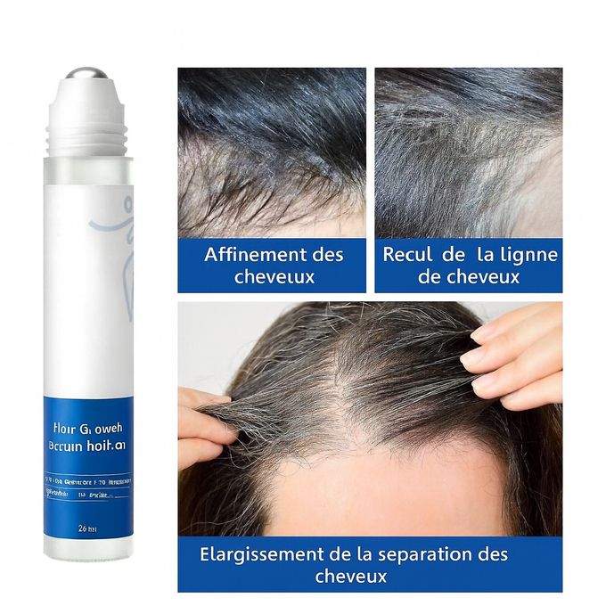 Sérum roll-on pour la croissance des cheveux
