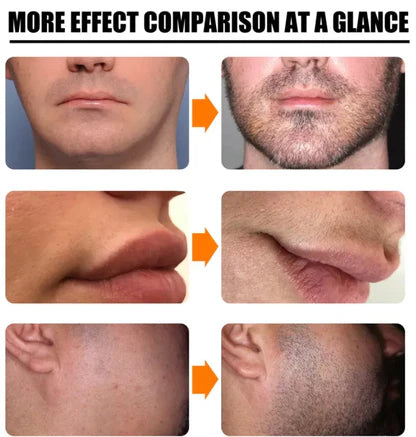 Ensemble de rouleaux de croissance de barbe naturels pour hommes